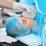 The Benefits of Sleep Apnea Surgery in Treating Severe Cases